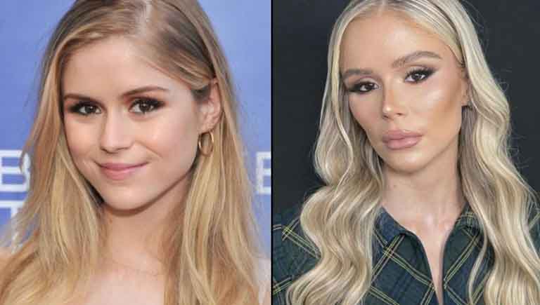 Erin Moriarty Surgery Rumors in The Boys