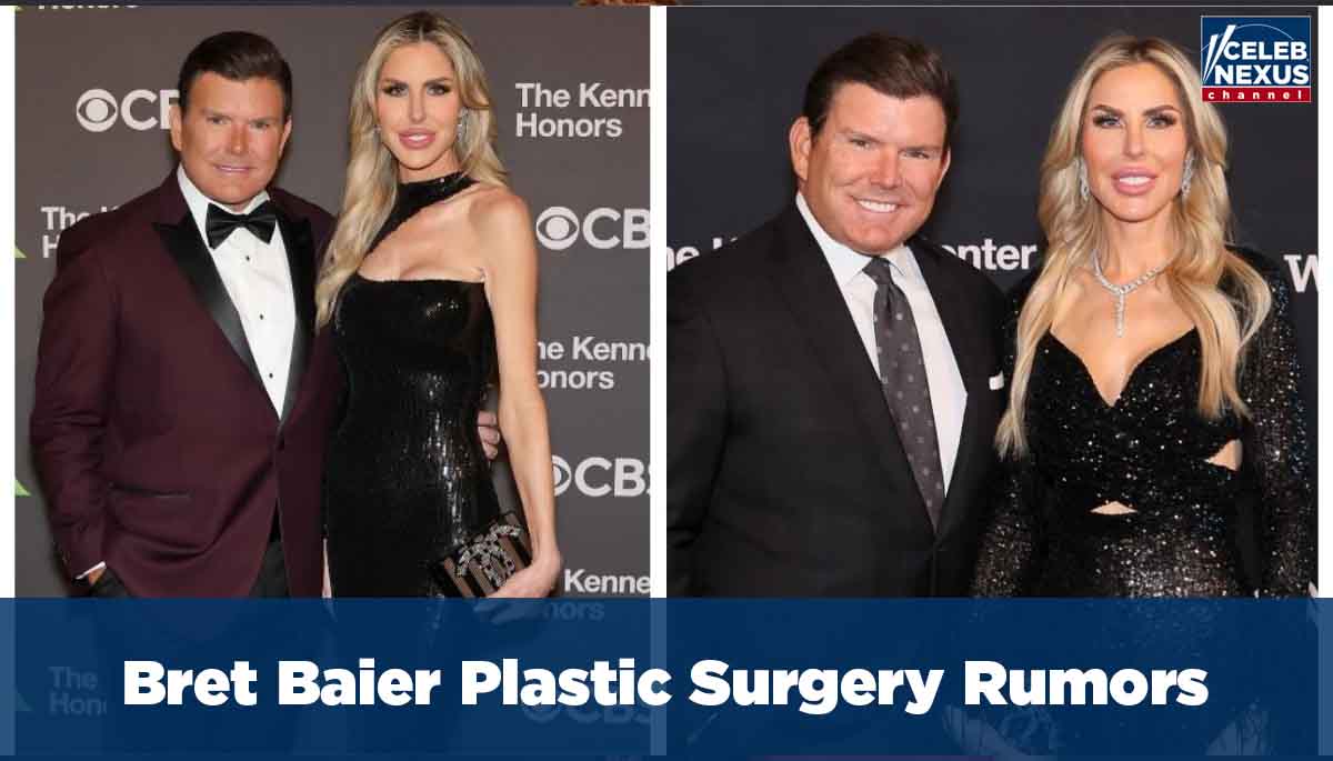 Bret Baier Plastic Surgery Rumors