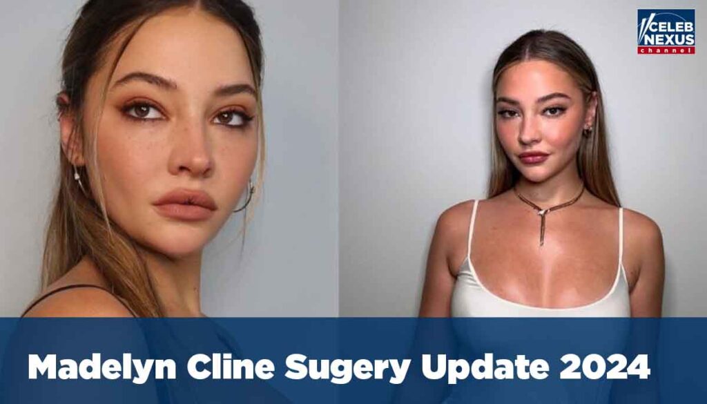 Madelyn Cline Sugery Update 2024