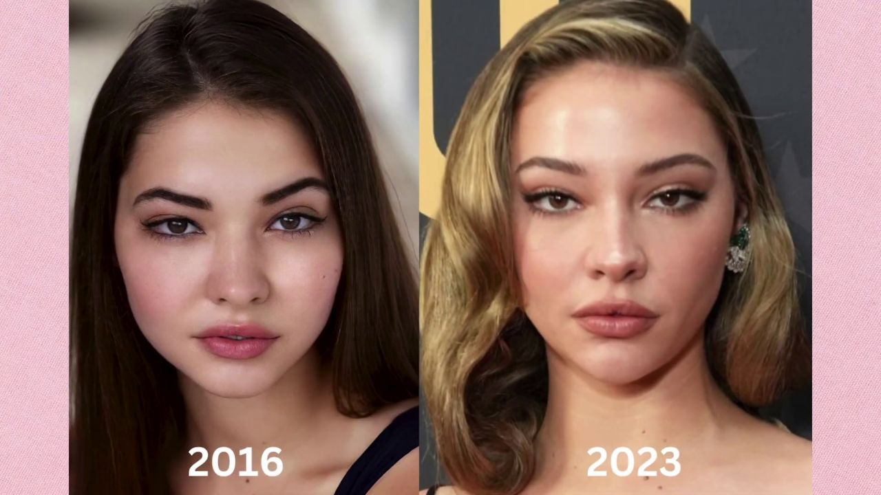 Did Madelyn Cline Get Lip Fillers for Outer Banks? Surgery Update 2024