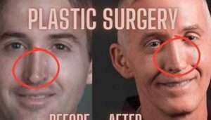 Has Trey Gowdy Gone Through Plastic Surgery? Before & After